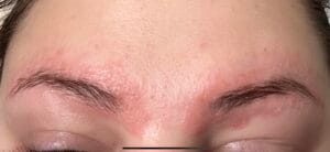 kulmude lamineerimine keemiline reaktsioon poletus scaled